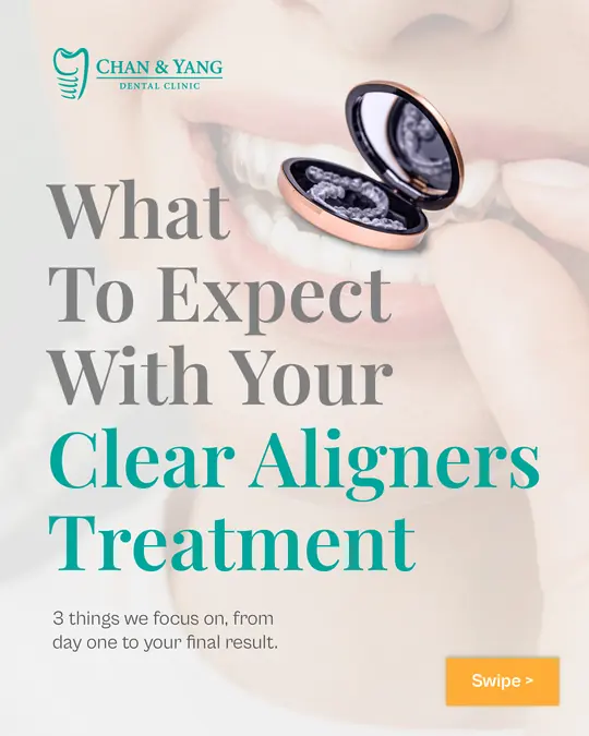 What to expect with clear aligners, patient education ad made by HPA for a Malaysian clinic