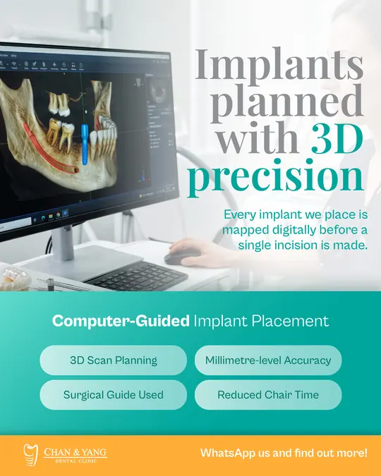 Implants planned in 3D, treatment demand ad made by HPA for a Malaysian clinic