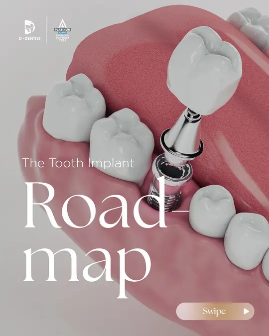 The dental implant roadmap, patient education ad made by HPA for a Malaysian clinic